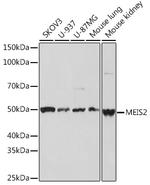 MEIS2 Recombinant Rabbit Monoclonal Antibody (2A6I3)