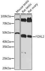 FOXL2 Recombinant Rabbit Monoclonal Antibody (4H5X3)