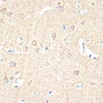 GUCY1B3 Antibody in Immunohistochemistry (Paraffin) (IHC (P))