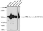 GUCY1B3 Antibody in Western Blot (WB)