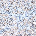 Histone H2A Recombinant Rabbit Monoclonal Antibody (1P5B6)