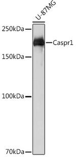 CNTNAP1 Recombinant Rabbit Monoclonal Antibody (8O5H6)