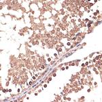 BANF1 Antibody in Immunohistochemistry (Paraffin) (IHC (P))