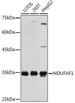 NDUFAF1 Antibody in Western Blot (WB)