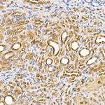 Thioredoxin 1 Antibody in Immunohistochemistry (Paraffin) (IHC (P))