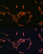PMP70 Recombinant Rabbit Monoclonal Antibody (3V4K3)
