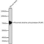 Placental Alkaline Phosphatase Antibody in Western Blot (WB)