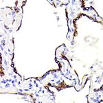 Cytokeratin 7 Antibody in Immunohistochemistry (Paraffin) (IHC (P))