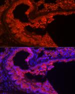 Cytokeratin 7 Antibody in Immunohistochemistry (Paraffin) (IHC (P))