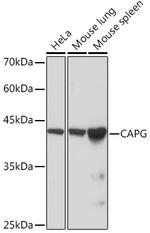 CAPG Recombinant Rabbit Monoclonal Antibody (5V9G1)