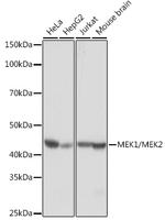 MEK1/MEK2 Recombinant Rabbit Monoclonal Antibody (2I4U3)