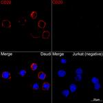 CD20 Recombinant Rabbit Monoclonal Antibody (6L3K5)