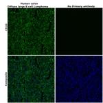 CD20 Antibody in Immunohistochemistry (Paraffin) (IHC (P))