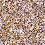 CD20 Antibody in Immunohistochemistry (Paraffin) (IHC (P))