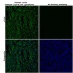 CD20 Antibody in Immunohistochemistry (Paraffin) (IHC (P))