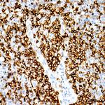 CD20 Antibody in Immunohistochemistry (Paraffin) (IHC (P))