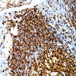 CD20 Antibody in Immunohistochemistry (Paraffin) (IHC (P))