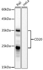 CD20 Antibody in Western Blot (WB)