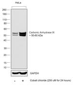 Carbonic Anhydrase IX Antibody