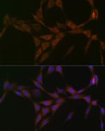 15-PGDH Recombinant Rabbit Monoclonal Antibody (2X4N7)