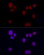 Brachyury Recombinant Rabbit Monoclonal Antibody (2F8Y9)