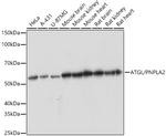 ATGL Recombinant Rabbit Monoclonal Antibody (10Y4M10)