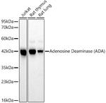 Adenosine Deaminase Recombinant Rabbit Monoclonal Antibody (5R10B4)