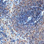 ELMO1 Antibody in Immunohistochemistry (Paraffin) (IHC (P))