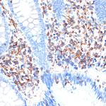 ELMO1 Recombinant Rabbit Monoclonal Antibody (9X6Y6)