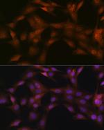 p23 Antibody in Immunocytochemistry (ICC/IF)