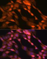 p23 Antibody in Immunocytochemistry (ICC/IF)