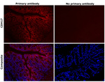 CDH17 Antibody in Immunohistochemistry (Paraffin) (IHC (P))