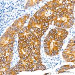 CDH17 Antibody in Immunohistochemistry (Paraffin) (IHC (P))