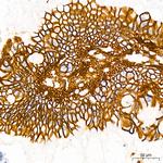 CDH17 Recombinant Rabbit Monoclonal Antibody (9X2S3)