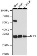 DLX5 Recombinant Rabbit Monoclonal Antibody (2F9C6)