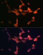 PIK3R4 Recombinant Rabbit Monoclonal Antibody (5J3U5)