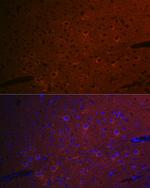 CEND Recombinant Rabbit Monoclonal Antibody (1D3Z1)