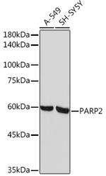 PARP2 Recombinant Rabbit Monoclonal Antibody (6G5U7)