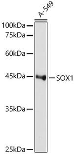 SOX1 Recombinant Rabbit Monoclonal Antibody (9L8Z4)