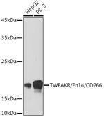 CD266 Recombinant Rabbit Monoclonal Antibody (1G4T3)