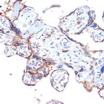 ARTS1 Recombinant Rabbit Monoclonal Antibody (6V8C0)