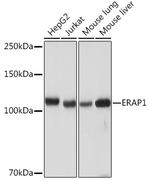 ARTS1 Antibody in Western Blot (WB)