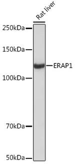 ARTS1 Antibody in Western Blot (WB)