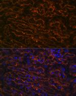 CYP26A1 Antibody in Immunocytochemistry (ICC/IF)