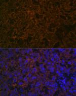 CYP26A1 Recombinant Rabbit Monoclonal Antibody (1E1D2)
