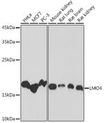 LMO4 Recombinant Rabbit Monoclonal Antibody (5C0I1)