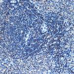 CHD3 Antibody in Immunohistochemistry (Paraffin) (IHC (P))
