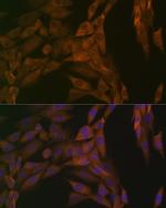 PP2A alpha/beta Recombinant Rabbit Monoclonal Antibody (4J2Z8)