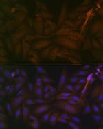 PP2A alpha/beta Antibody in Immunocytochemistry (ICC/IF)