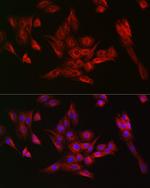 alpha Tubulin Antibody in Immunocytochemistry (ICC/IF)